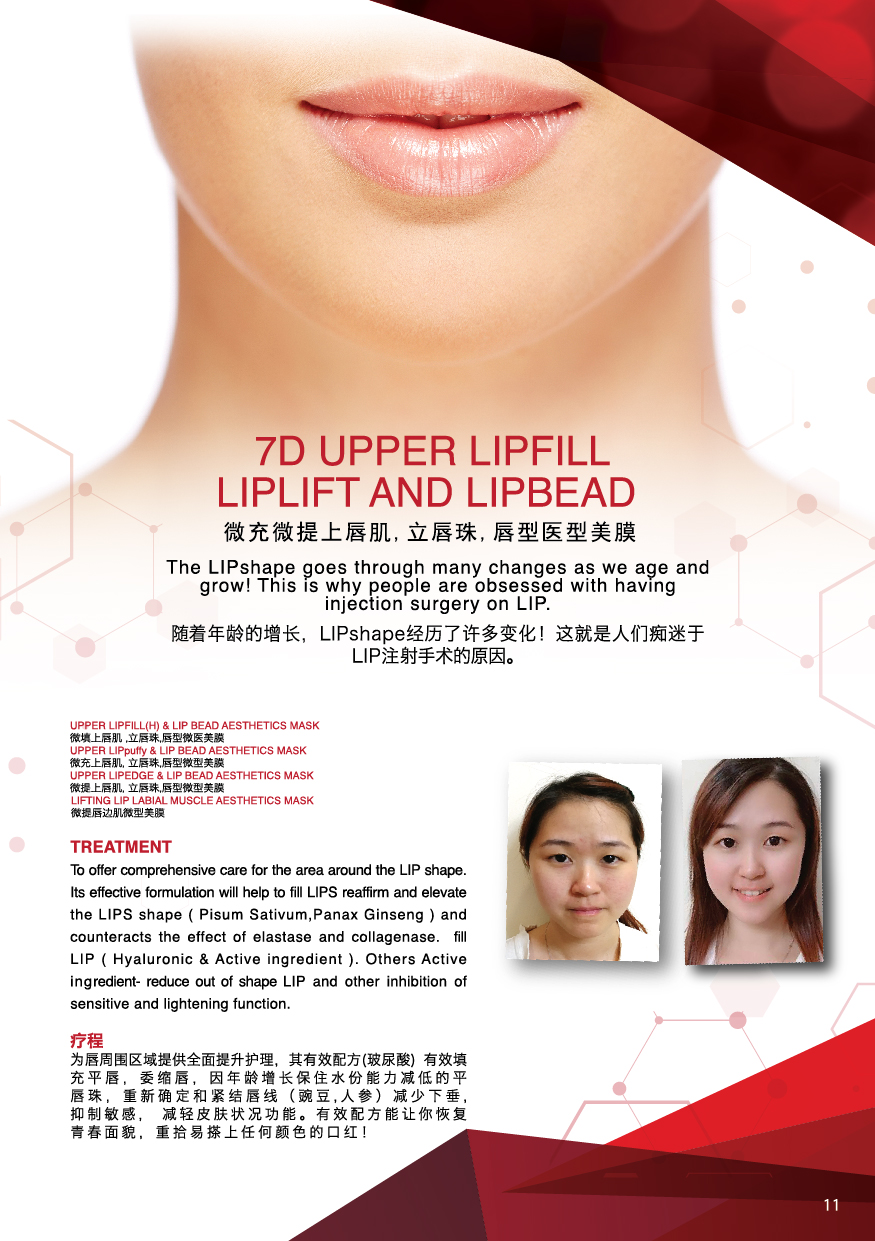 UPPER LIPFILL LIPLIFT AND LIPBEAD.jpg